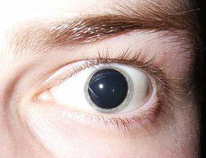 передозировка